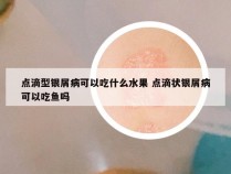 点滴型银屑病可以吃什么水果 点滴状银屑病可以吃鱼吗