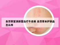 自然草堂清肤霜治疗牛皮癣 自然草本护肤品怎么样