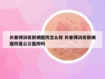 长春博润皮肤病医院怎么样 长春博润皮肤病医院是公立医院吗