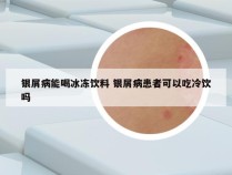银屑病能喝冰冻饮料 银屑病患者可以吃冷饮吗