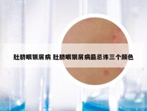 肚脐眼银屑病 肚脐眼银屑病最忌讳三个颜色