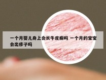 一个月婴儿身上会长牛皮癣吗 一个月的宝宝会出疹子吗