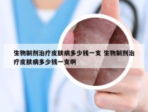 生物制剂治疗皮肤病多少钱一支 生物制剂治疗皮肤病多少钱一支啊