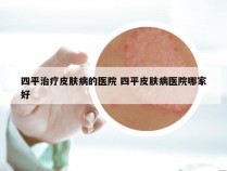 四平治疗皮肤病的医院 四平皮肤病医院哪家好