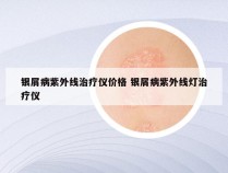 银屑病紫外线治疗仪价格 银屑病紫外线灯治疗仪