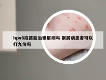 hpv6疫苗能治银屑病吗 银屑病患者可以打九价吗