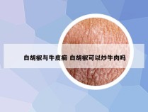白胡椒与牛皮癣 白胡椒可以炒牛肉吗