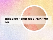 脚掌泛白特厚一层图片 脚掌白了好大一片怎么办