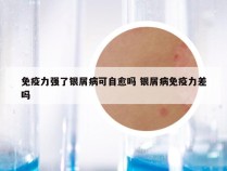 免疫力强了银屑病可自愈吗 银屑病免疫力差吗