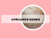 从肝脾论治银屑病 银屑病脾虚