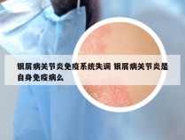 银屑病关节炎免疫系统失调 银屑病关节炎是自身免疫病么