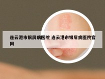 连云港市银屑病医院 连云港市银屑病医院官网