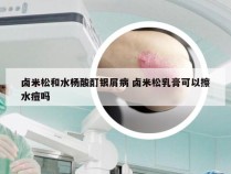 卤米松和水杨酸酊银屑病 卤米松乳膏可以擦水痘吗