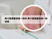 两个腿窝都有癣一样的 两个腿窝都有癣一样的痒