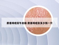 麝香痔疮膏牛皮癣 麝香痔疮膏多少钱一只