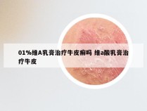 01%维A乳膏治疗牛皮癣吗 维a酸乳膏治疗牛皮