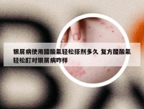 银屑病使用醋酸氟轻松搽剂多久 复方醋酸氟轻松酊对银屑病咋样