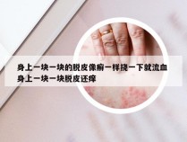 身上一块一块的脱皮像癣一样挠一下就流血 身上一块一块脱皮还痒
