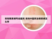安阳银屑病专业医院 安阳中医院治银屑病怎么样