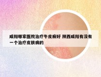 咸阳哪家医院治疗牛皮癣好 陕西咸阳有没有一个治疗皮肤病的