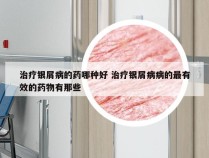 治疗银屑病的药哪种好 治疗银屑病病的最有效的药物有那些