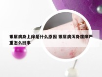 银屑病身上痒是什么原因 银屑病浑身瘙痒严重怎么回事