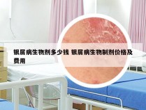 银屑病生物剂多少钱 银屑病生物制剂价格及费用