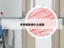外阴银屑病什么原因