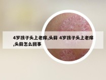 4岁孩子头上老痒,头藓 4岁孩子头上老痒,头藓怎么回事