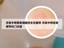 济南中研银屑病医院主任医师 济南中研皮肤病专科门诊部