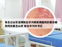 有去过山东淄博桓台华沟银屑病医院的看白癜风吗效果怎么样 桓台华沟村书记
