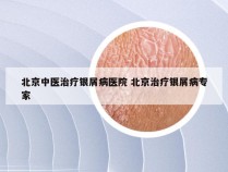 北京中医治疗银屑病医院 北京治疗银屑病专家