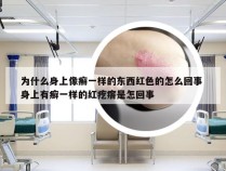 为什么身上像癣一样的东西红色的怎么回事 身上有癣一样的红疙瘩是怎回事