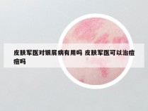 皮肤军医对银屑病有用吗 皮肤军医可以治痘痘吗