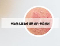 卡泊什么膏治疗银屑病的 卡泊擦剂