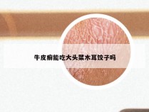 牛皮癣能吃大头菜木耳饺子吗