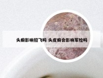 头癣影响招飞吗 头皮癣会影响军检吗