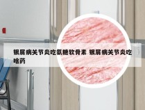 银屑病关节炎吃氨糖软骨素 银屑病关节炎吃啥药