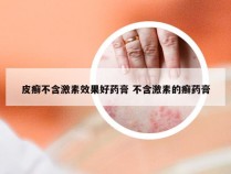 皮癣不含激素效果好药膏 不含激素的癣药膏