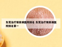 东莞治疗银屑病医院排名 东莞治疗银屑病医院排名第一