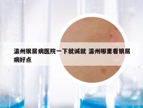 温州银屑病医院一下就诚就 温州哪里看银屑病好点