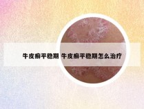 牛皮癣平稳期 牛皮癣平稳期怎么治疗