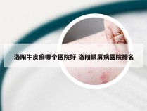 洛阳牛皮癣哪个医院好 洛阳银屑病医院排名