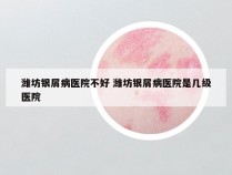 潍坊银屑病医院不好 潍坊银屑病医院是几级医院