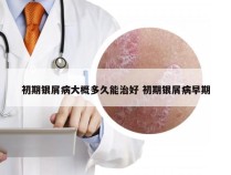 初期银屑病大概多久能治好 初期银屑病早期
