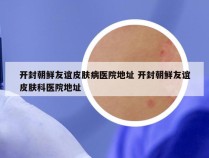 开封朝鲜友谊皮肤病医院地址 开封朝鲜友谊皮肤科医院地址