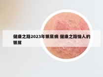 健康之路2023年银屑病 健康之路恼人的银屑