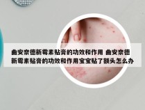 曲安奈德新霉素贴膏的功效和作用 曲安奈德新霉素贴膏的功效和作用宝宝贴了额头怎么办