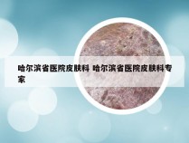哈尔滨省医院皮肤科 哈尔滨省医院皮肤科专家