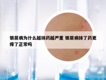 银屑病为什么越抹药越严重 银屑病抹了药更痒了正常吗